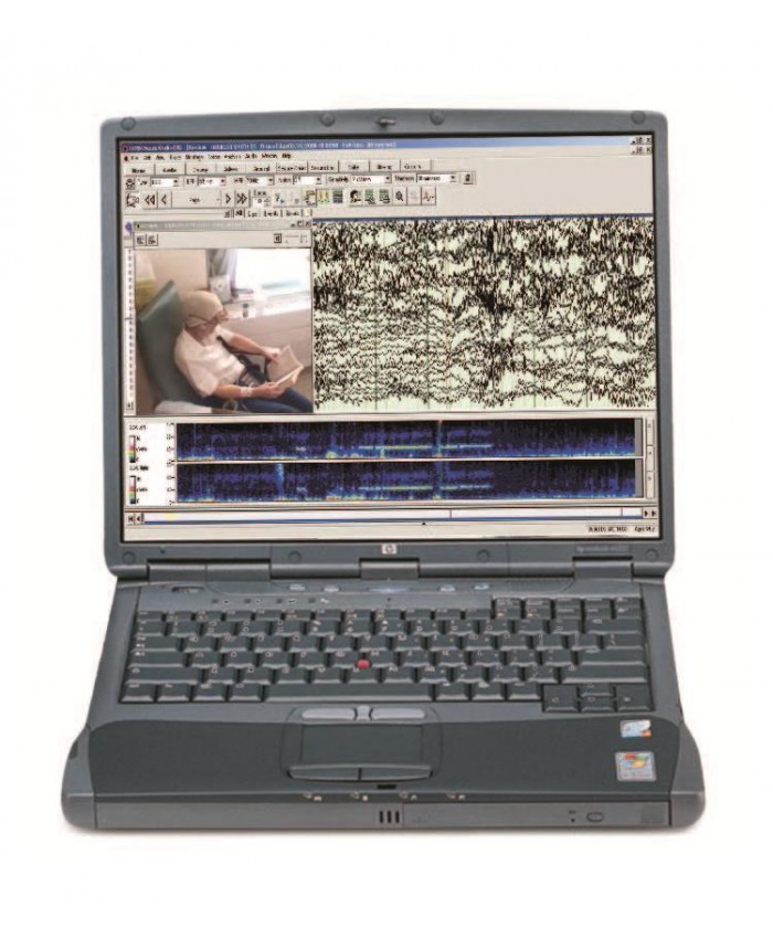  Trex  HD Video Ambulatory EEG